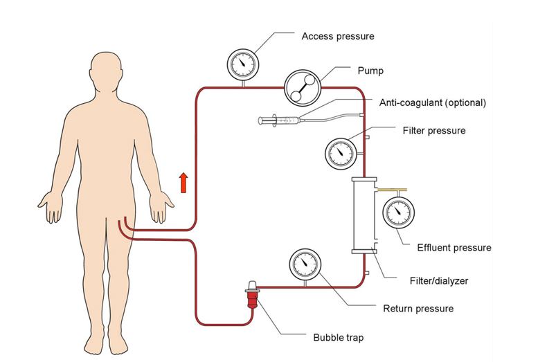 CVVHF circuit diagram